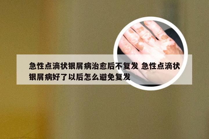 急性点滴状银屑病治愈后不复发 急性点滴状银屑病好了以后怎么避免复发