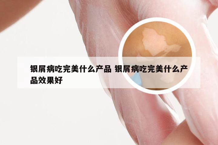 银屑病吃完美什么产品 银屑病吃完美什么产品效果好