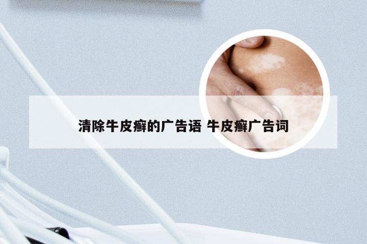 清除牛皮癣的广告语 牛皮癣广告词