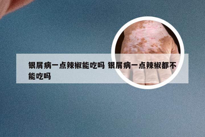 银屑病一点辣椒能吃吗 银屑病一点辣椒都不能吃吗