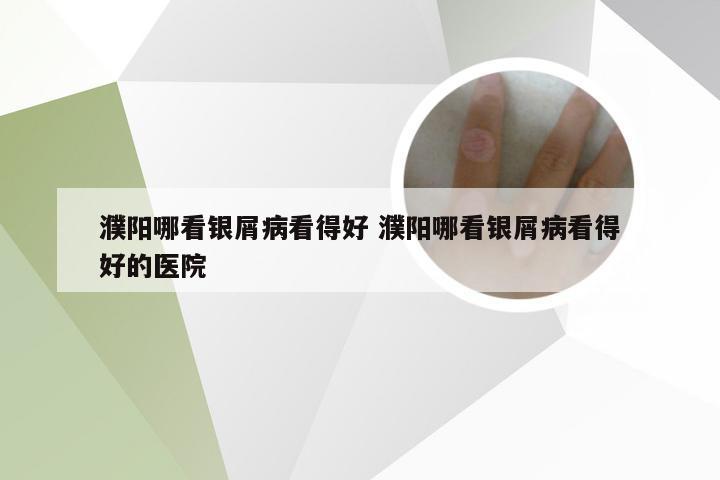 濮阳哪看银屑病看得好 濮阳哪看银屑病看得好的医院