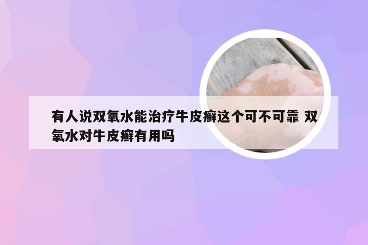 有人说双氧水能治疗牛皮癣这个可不可靠 双氧水对牛皮癣有用吗
