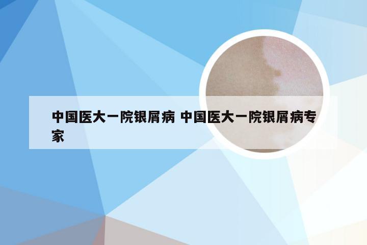 中国医大一院银屑病 中国医大一院银屑病专家