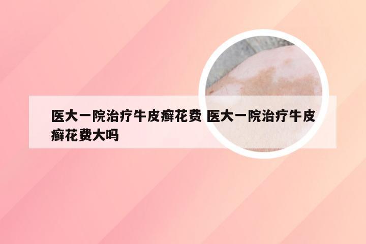 医大一院治疗牛皮癣花费 医大一院治疗牛皮癣花费大吗