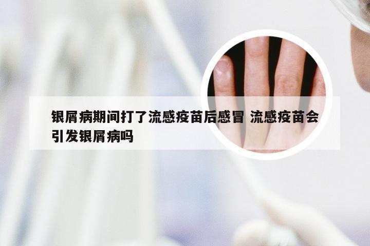 银屑病期间打了流感疫苗后感冒 流感疫苗会引发银屑病吗