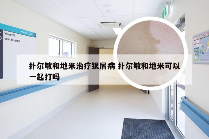 扑尔敏和地米治疗银屑病 扑尔敏和地米可以一起打吗