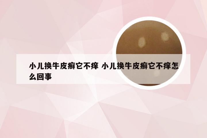 小儿换牛皮癣它不痒 小儿换牛皮癣它不痒怎么回事