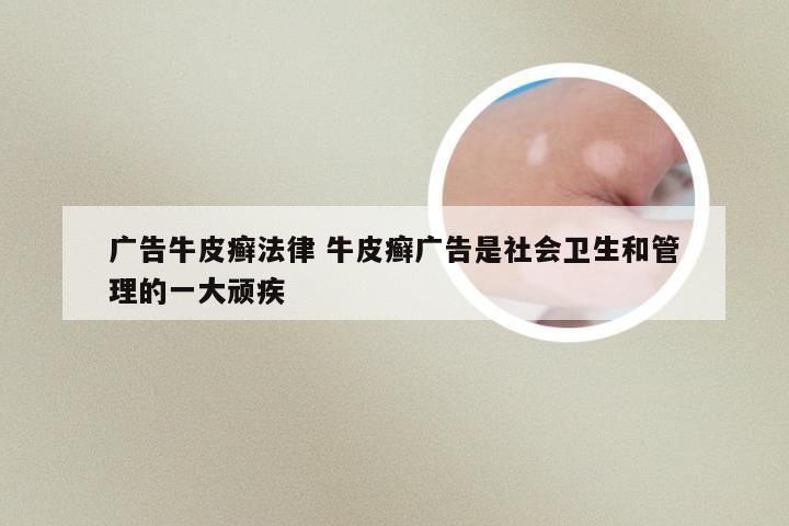 广告牛皮癣法律 牛皮癣广告是社会卫生和管理的一大顽疾