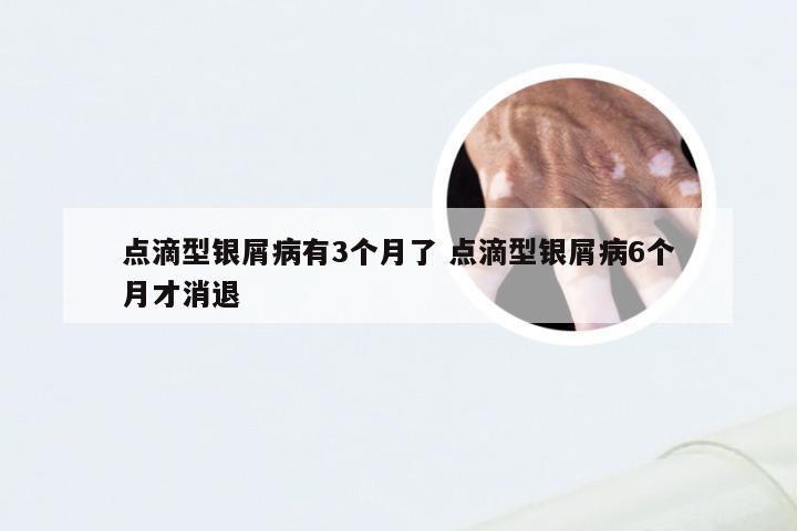 点滴型银屑病有3个月了 点滴型银屑病6个月才消退