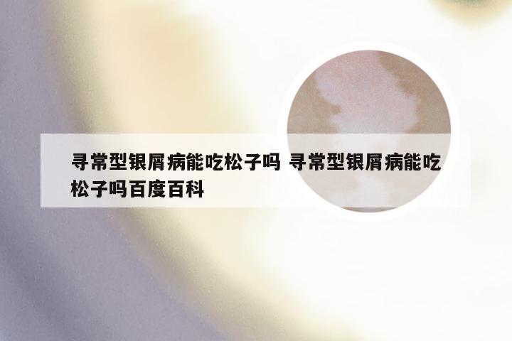 寻常型银屑病能吃松子吗 寻常型银屑病能吃松子吗百度百科