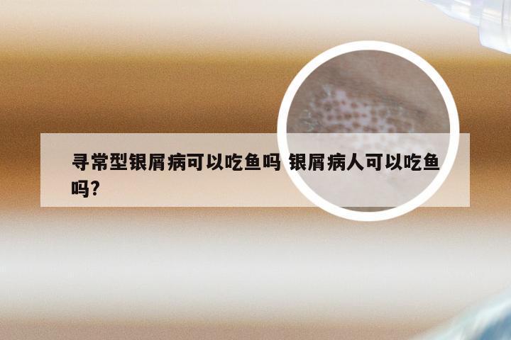 寻常型银屑病可以吃鱼吗 银屑病人可以吃鱼吗?
