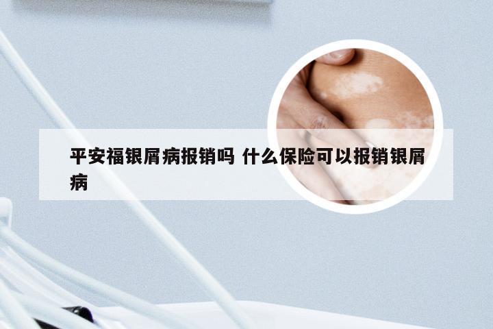平安福银屑病报销吗 什么保险可以报销银屑病