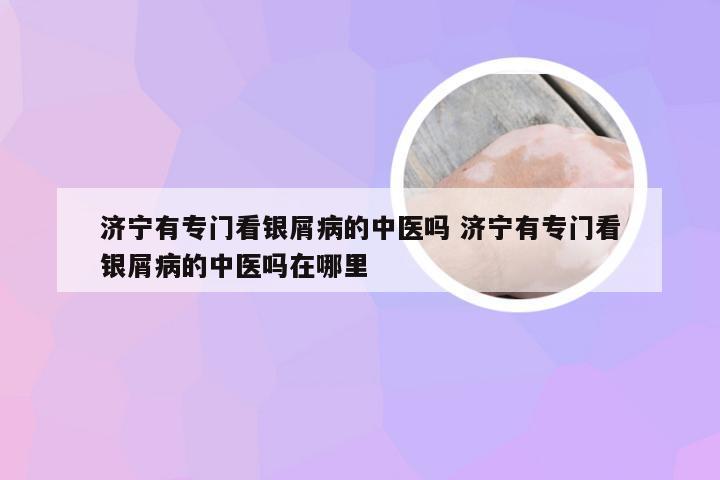 济宁有专门看银屑病的中医吗 济宁有专门看银屑病的中医吗在哪里