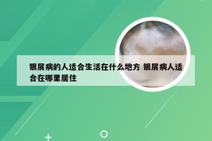 银屑病的人适合生活在什么地方 银屑病人适合在哪里居住