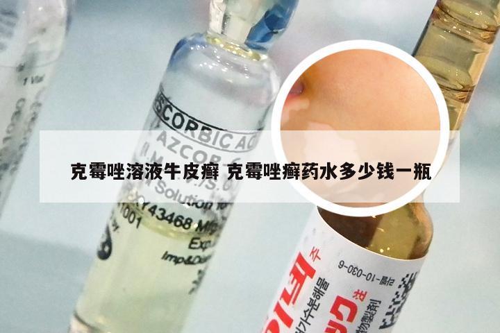 克霉唑溶液牛皮癣 克霉唑癣药水多少钱一瓶