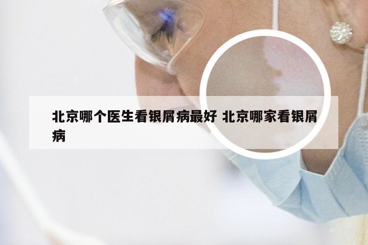 北京哪个医生看银屑病最好 北京哪家看银屑病