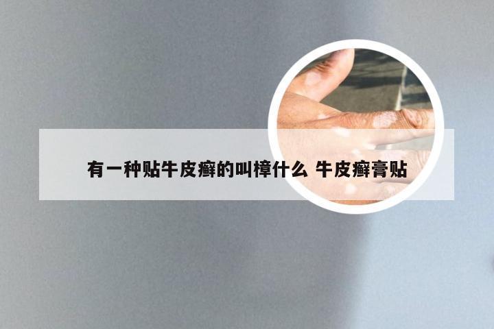 有一种贴牛皮癣的叫樟什么 牛皮癣膏贴