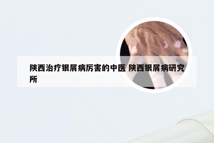 陕西治疗银屑病厉害的中医 陕西银屑病研究所