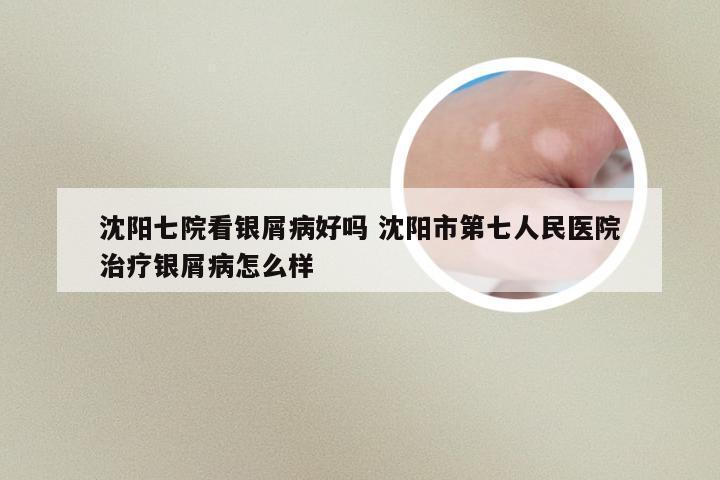 沈阳七院看银屑病好吗 沈阳市第七人民医院治疗银屑病怎么样