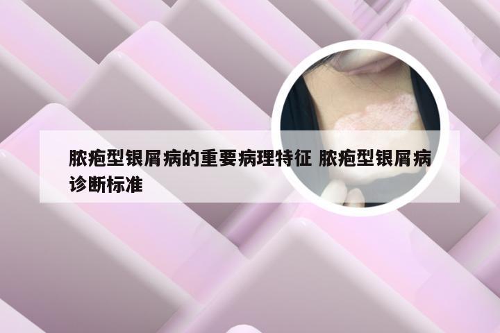 脓疱型银屑病的重要病理特征 脓疱型银屑病诊断标准