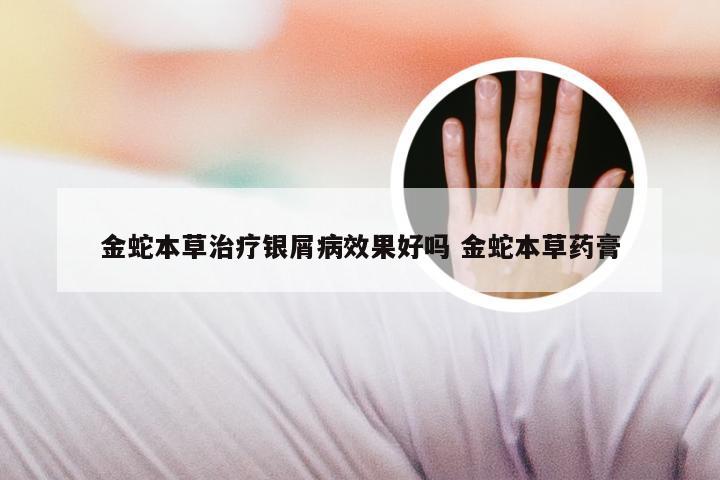 金蛇本草治疗银屑病效果好吗 金蛇本草药膏