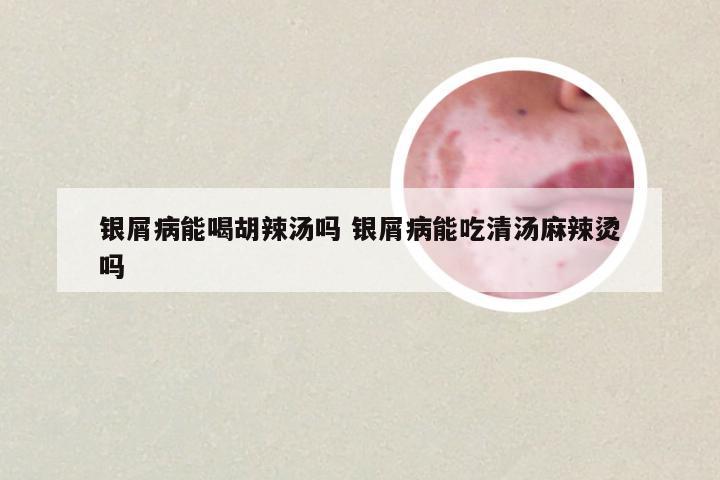 银屑病能喝胡辣汤吗 银屑病能吃清汤麻辣烫吗