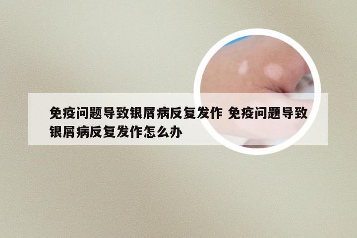 免疫问题导致银屑病反复发作 免疫问题导致银屑病反复发作怎么办