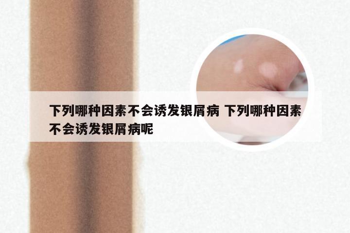 下列哪种因素不会诱发银屑病 下列哪种因素不会诱发银屑病呢