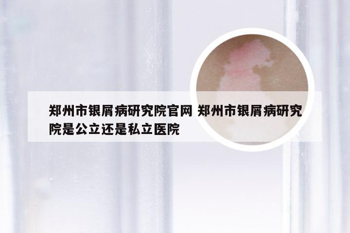 郑州市银屑病研究院官网 郑州市银屑病研究院是公立还是私立医院