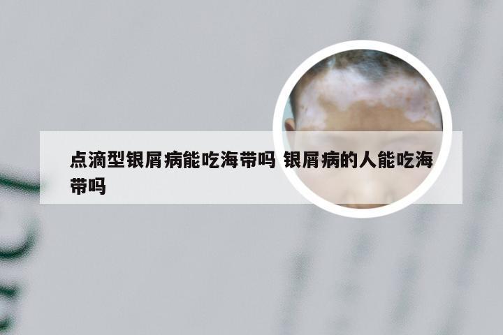 点滴型银屑病能吃海带吗 银屑病的人能吃海带吗