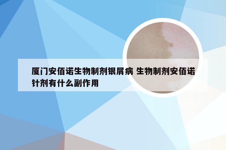 厦门安佰诺生物制剂银屑病 生物制剂安佰诺针剂有什么副作用