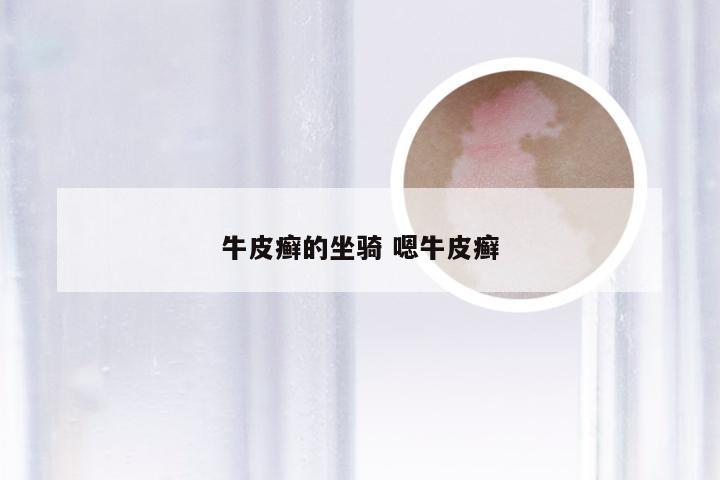 牛皮癣的坐骑 嗯牛皮癣