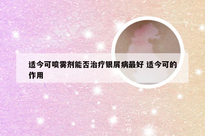 适今可喷雾剂能否治疗银屑病最好 适今可的作用
