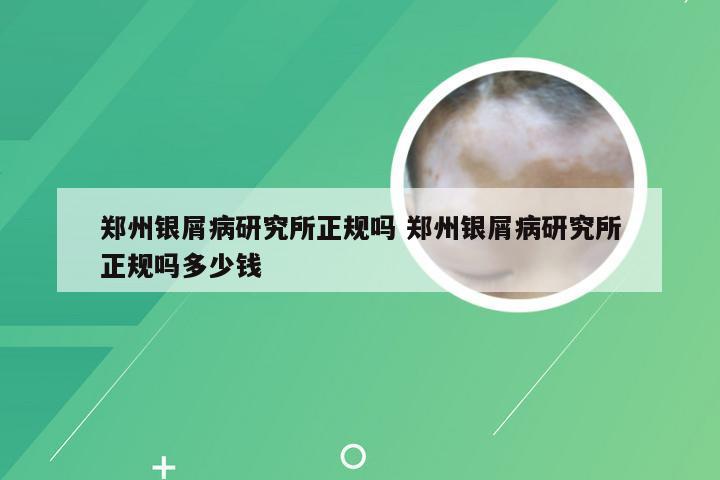 郑州银屑病研究所正规吗 郑州银屑病研究所正规吗多少钱