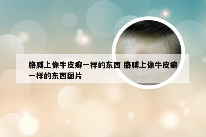 胳膊上像牛皮癣一样的东西 胳膊上像牛皮癣一样的东西图片