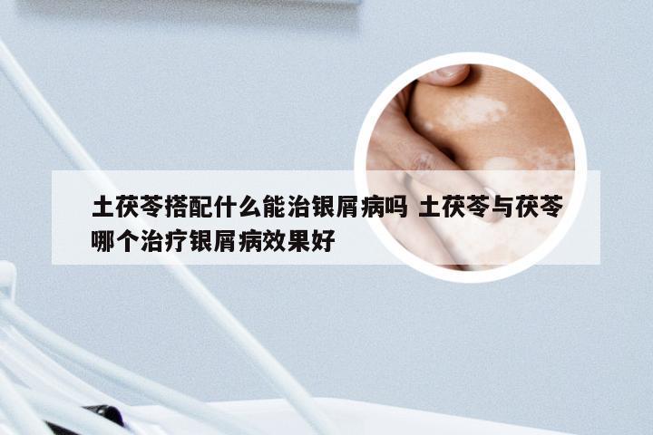 土茯苓搭配什么能治银屑病吗 土茯苓与茯苓哪个治疗银屑病效果好