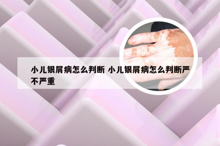 小儿银屑病怎么判断 小儿银屑病怎么判断严不严重