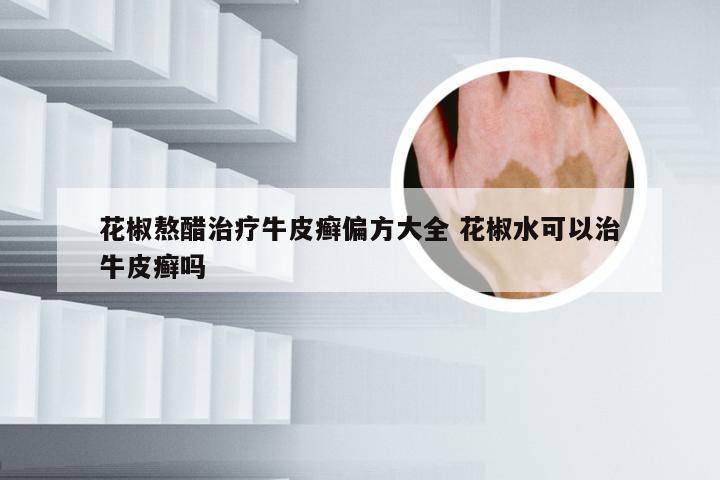 花椒熬醋治疗牛皮癣偏方大全 花椒水可以治牛皮癣吗