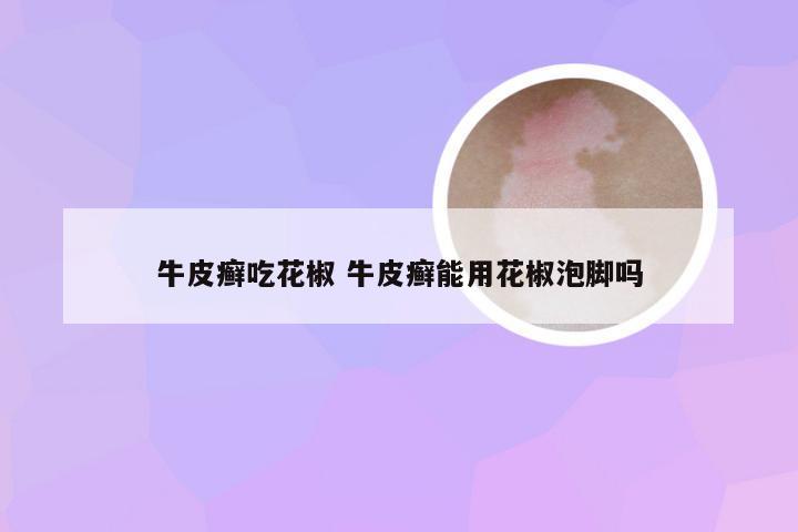 牛皮癣吃花椒 牛皮癣能用花椒泡脚吗