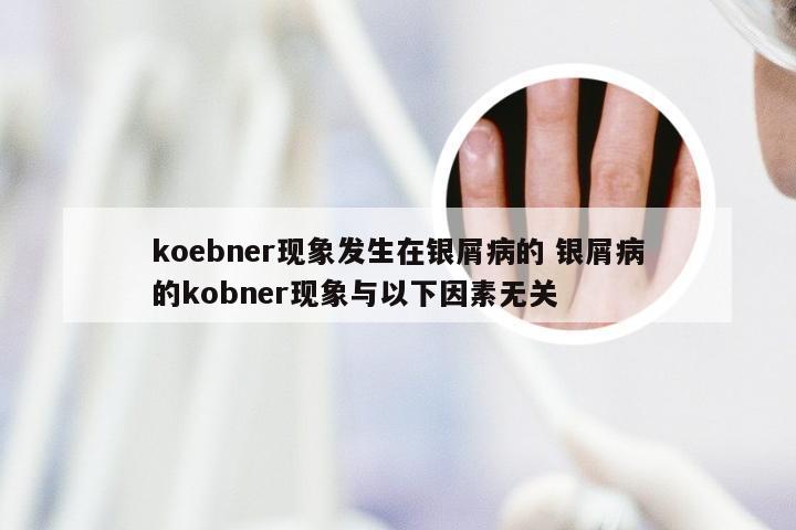 koebner现象发生在银屑病的 银屑病的kobner现象与以下因素无关