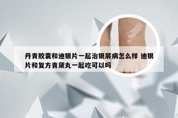 丹青胶囊和迪银片一起治银屑病怎么样 迪银片和复方青黛丸一起吃可以吗