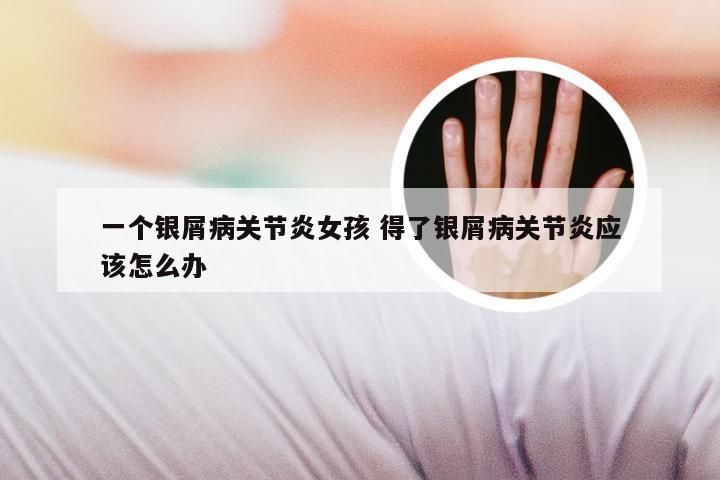 一个银屑病关节炎女孩 得了银屑病关节炎应该怎么办