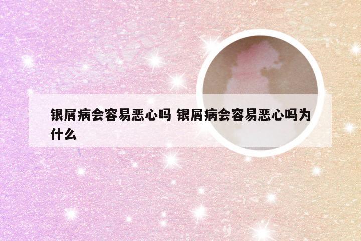 银屑病会容易恶心吗 银屑病会容易恶心吗为什么