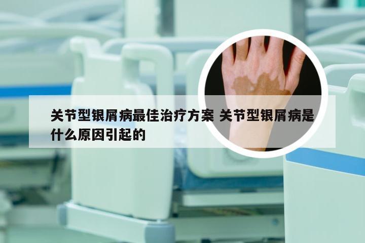 关节型银屑病最佳治疗方案 关节型银屑病是什么原因引起的