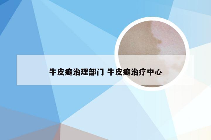 牛皮癣治理部门 牛皮癣治疗中心