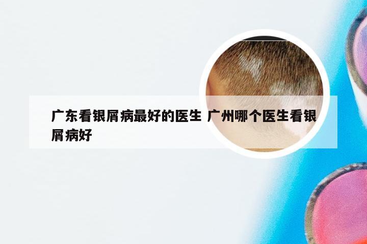广东看银屑病最好的医生 广州哪个医生看银屑病好
