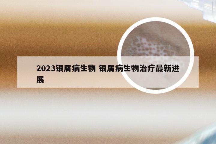 2023银屑病生物 银屑病生物治疗最新进展