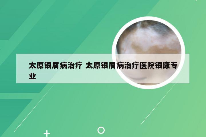 太原银屑病治疗 太原银屑病治疗医院银康专业