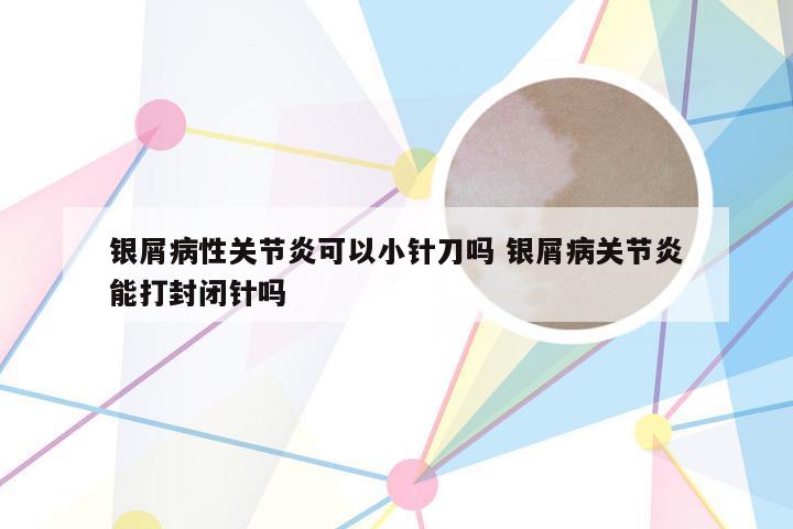 银屑病性关节炎可以小针刀吗 银屑病关节炎能打封闭针吗