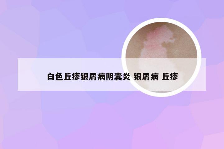 白色丘疹银屑病阴囊炎 银屑病 丘疹
